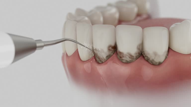 Reliable Dental contractor in East Canton, OH by Dentist Open Now